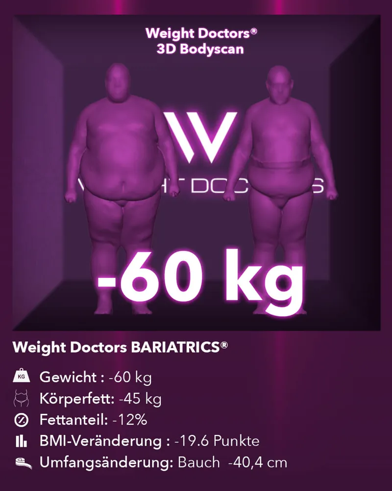 Weight Doctors® 3D-Bodyscan vorher und nachher: minus 60 kg mit Weight Doctors BARIATRICS®, Körperfett minus 45 kg
