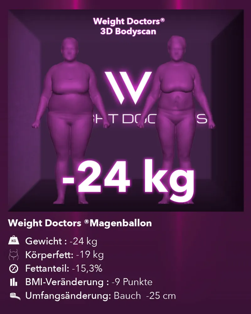 Weight Doctors® 3D-Bodyscan vorher und nachher: minus 24 kg mit dem Weight Doctors® MAGENBALLON, Körperfett minus 19 kg