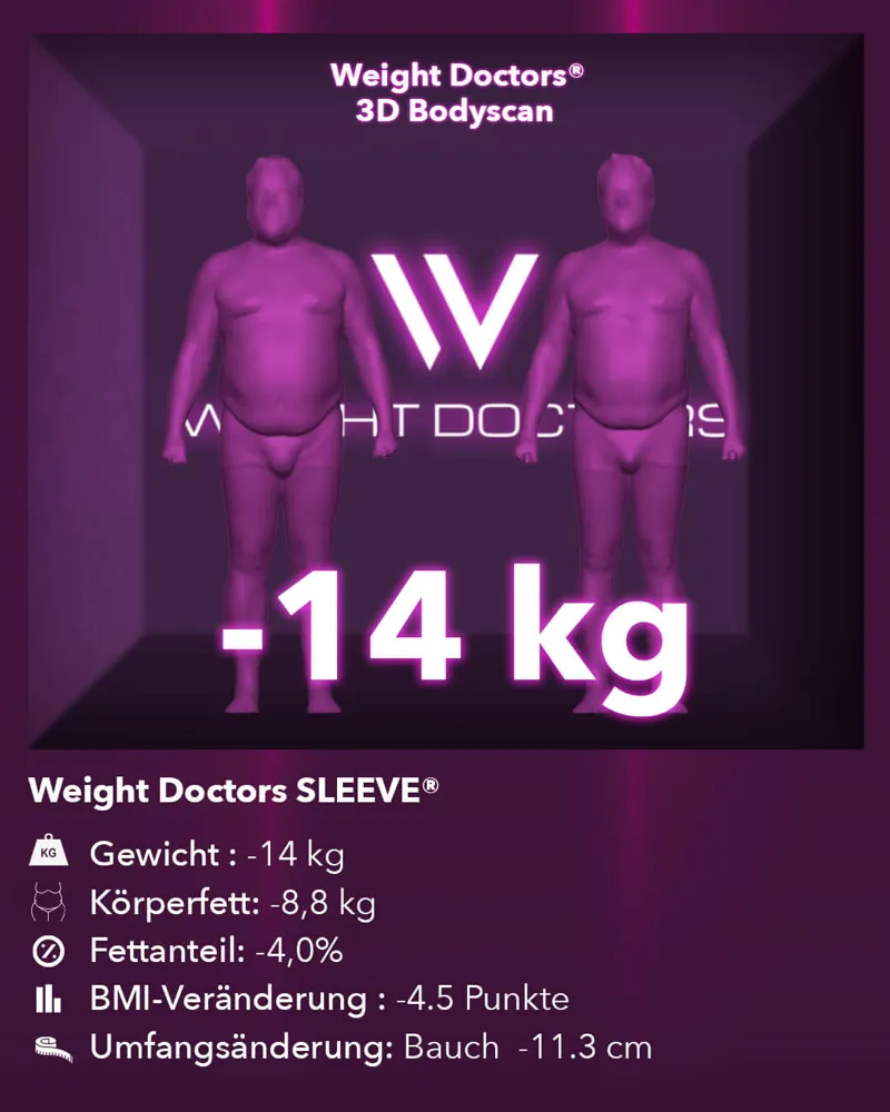 Weight Doctors® 3D-Bodyscan vorher und nachher: minus 14 kg mit Weight Doctors SLEEVE®, Körperfett minus 8,8 kg