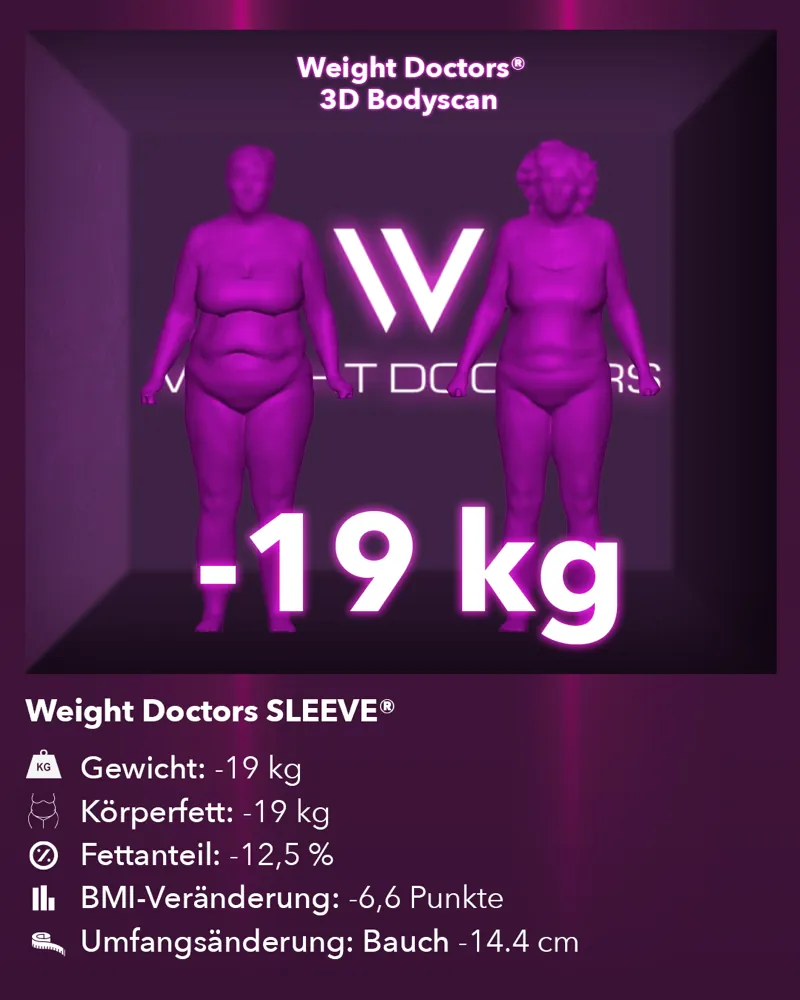 Weight Doctors® 3D-Bodyscan vorher und nachher: minus 19 kg mit Weight Doctors SLEEVE®, Körperfett minus 19 kg