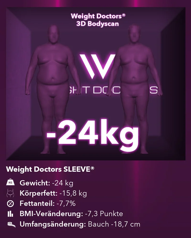 Weight Doctors® 3D-Bodyscan vorher und nachher: minus 24 kg mit Weight Doctors SLEEVE®, Körperfett minus 15,8 kg