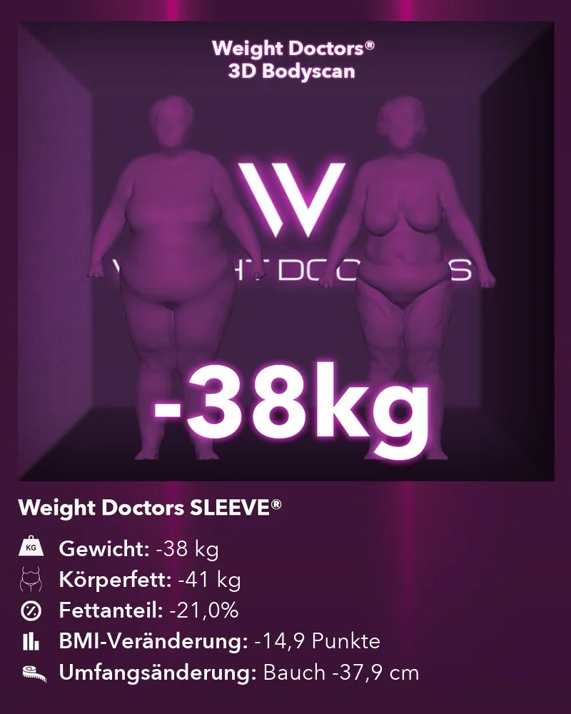 Weight Doctors® 3D-Bodyscan vorher und nachher: minus 38 kg mit Weight Doctors SLEEVE®, Körperfett minus 41 kg