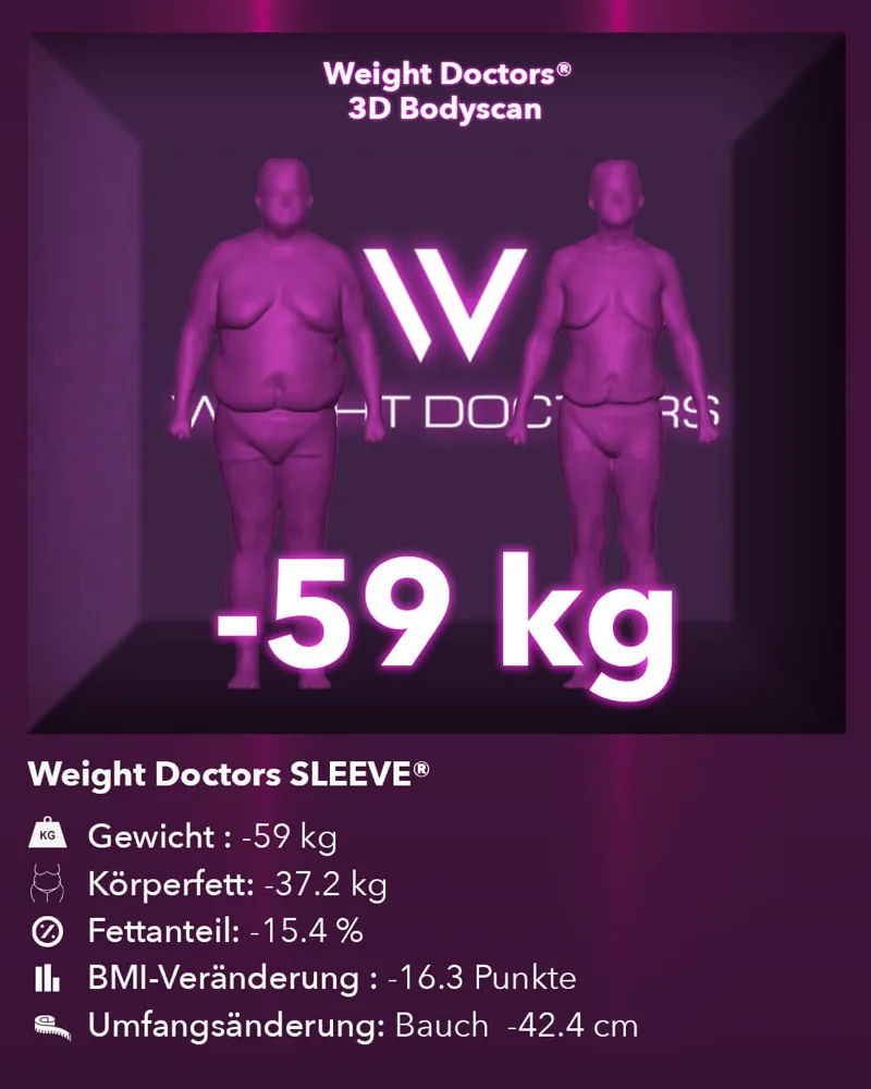 Weight Doctors® 3D-Bodyscan vorher und nachher: minus 59 kg mit Weight Doctors SLEEVE®, Körperfett minus 37,2 kg