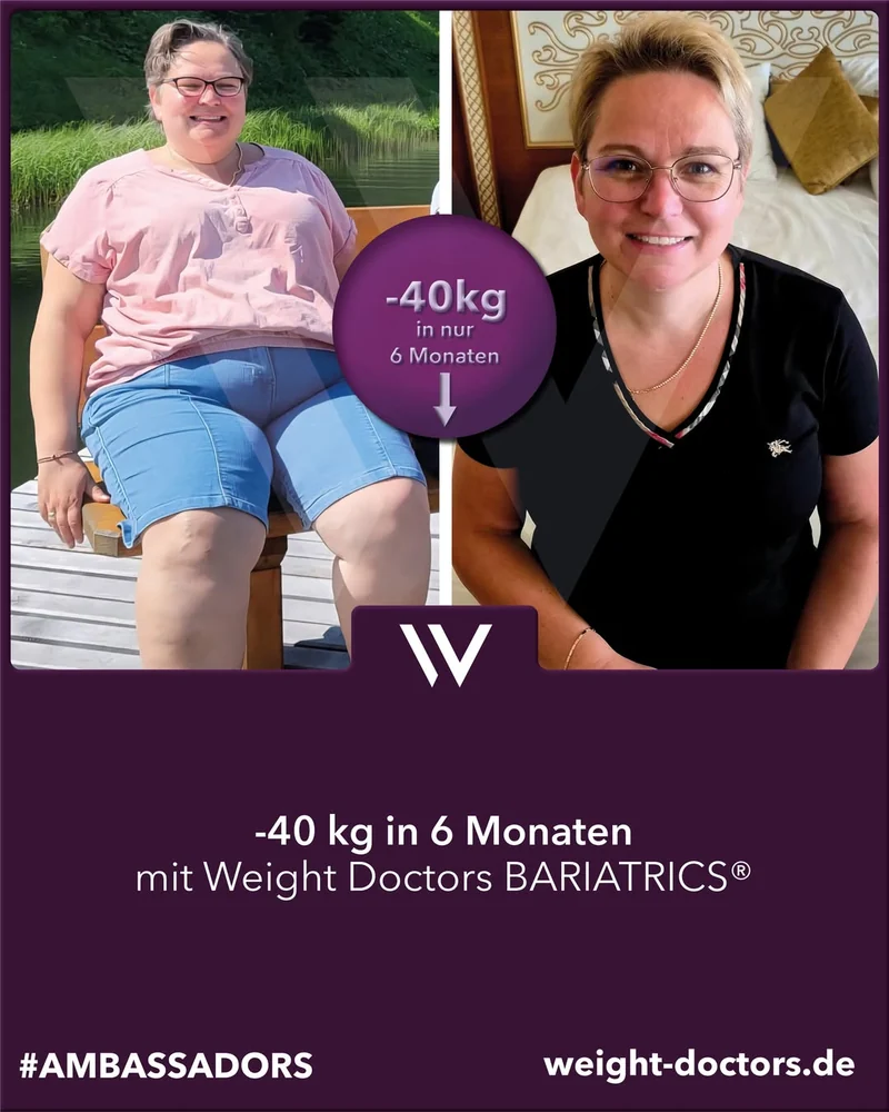 Weight Doctors® Vorher-Nachher: Patientin mit 40 kg weniger in sechs Monaten, mit Weight Doctors BARIATRICS®