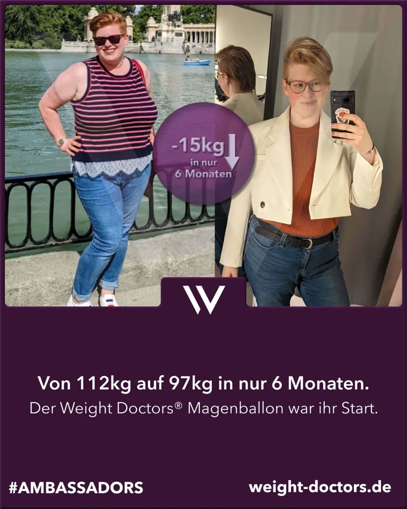 Weight Doctors® Vorher-Nachher: Patientin von 112 kg auf 97 kg in sechs Monaten, mit dem Weight Doctors® MAGENBALLON