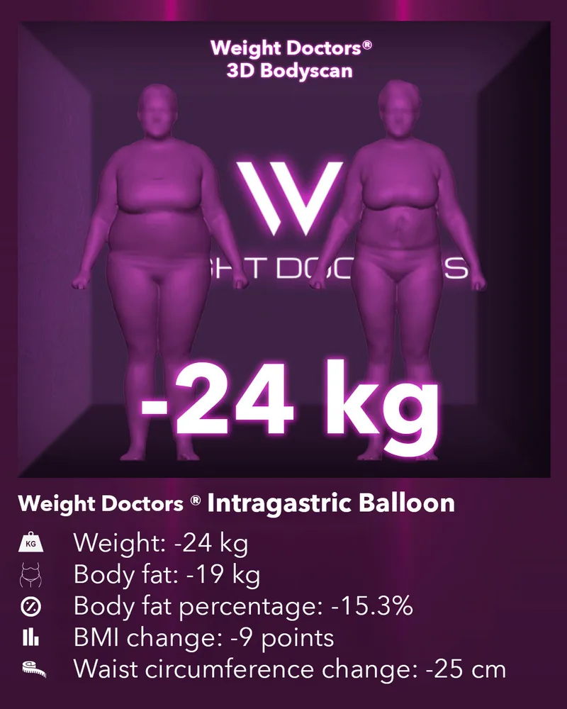 Weight Doctors® 3D Bodyscan before and after: minus 24 kg with the Weight Doctors® GASTRIC BALLOON, body fat minus 19 kg