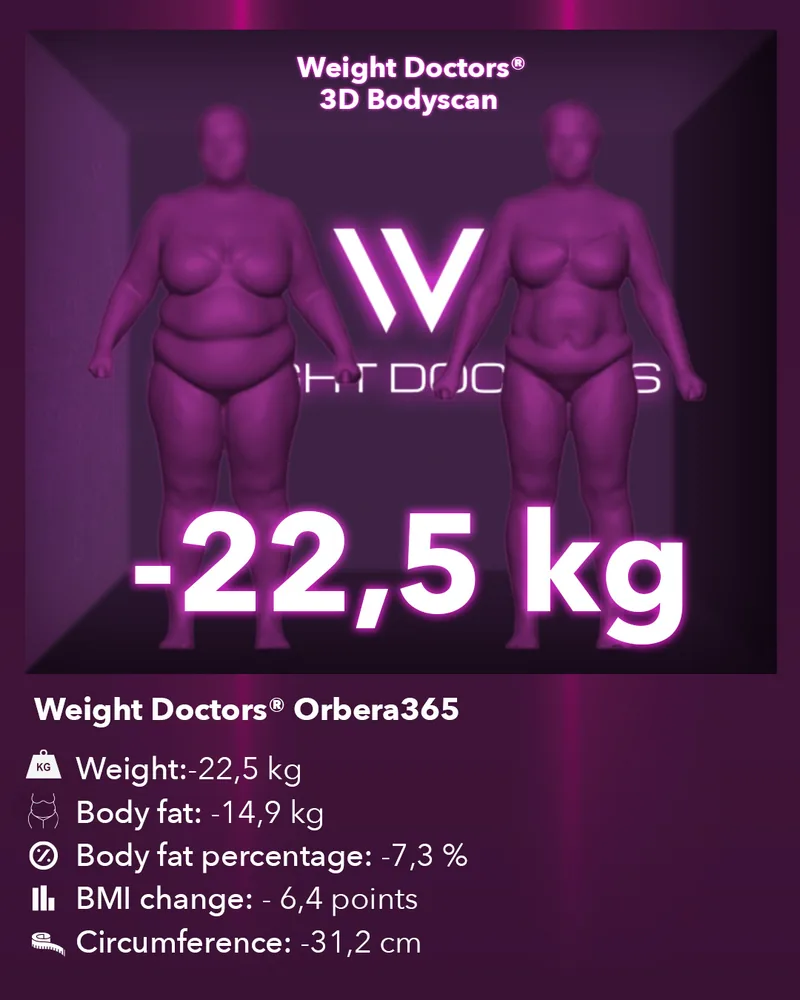 Weight Doctors® 3D Bodyscan before and after: minus 22.5 kg with the Orbera365 gastric balloon, body fat minus 14.9 kg