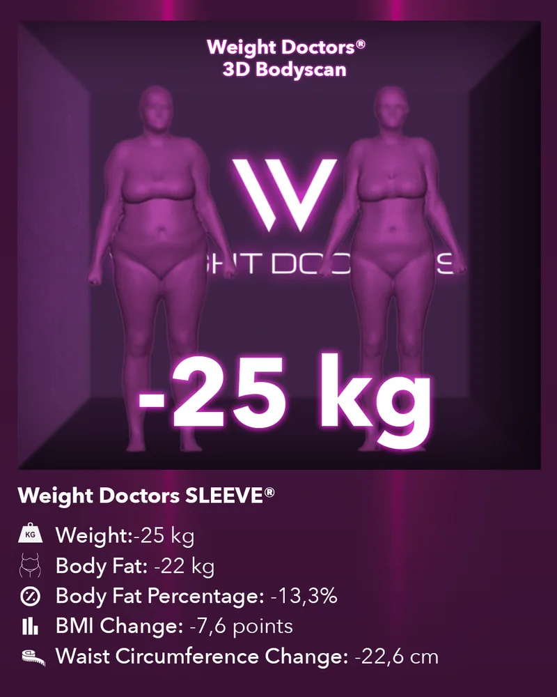 Weight Doctors® 3D Bodyscan before and after: minus 25 kg with Weight Doctors SLEEVE®, body fat minus 22 kg