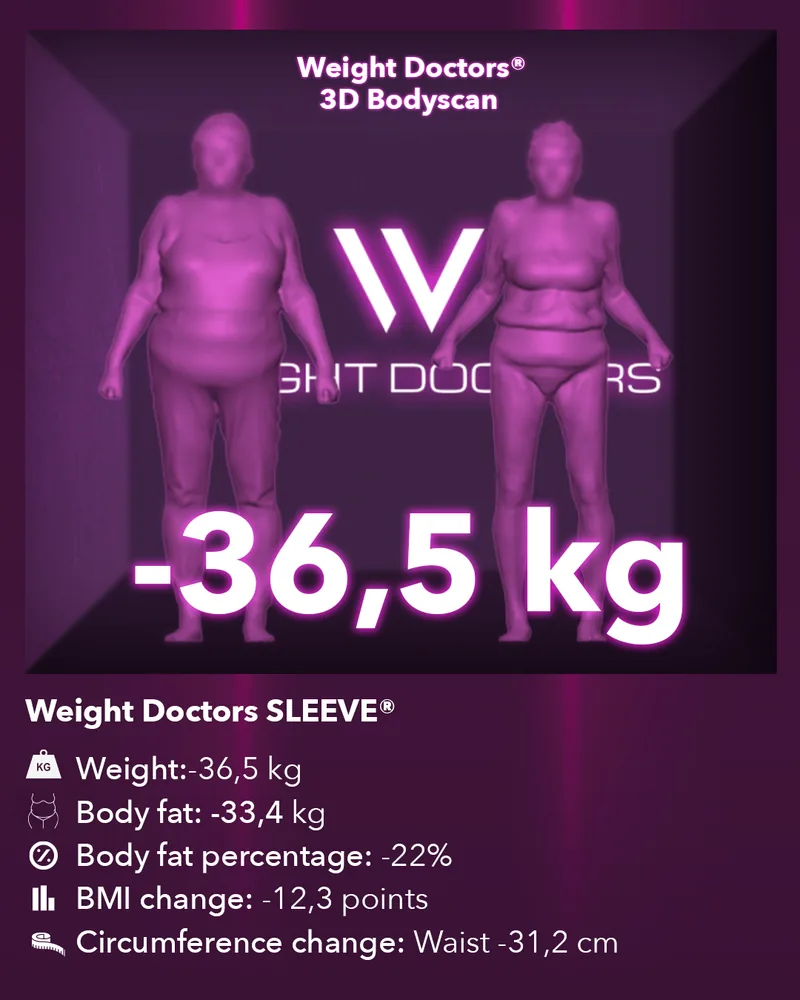 Weight Doctors® 3D Bodyscan before and after: minus 36.5 kg with Weight Doctors SLEEVE®, body fat minus 33.4 kg