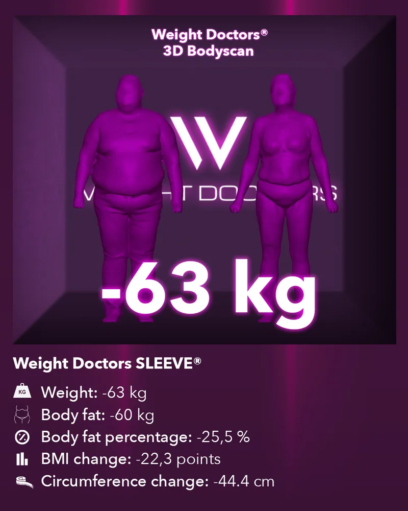Weight Doctors® 3D Bodyscan before and after: minus 63 kg with Weight Doctors SLEEVE®, body fat minus 60 kg