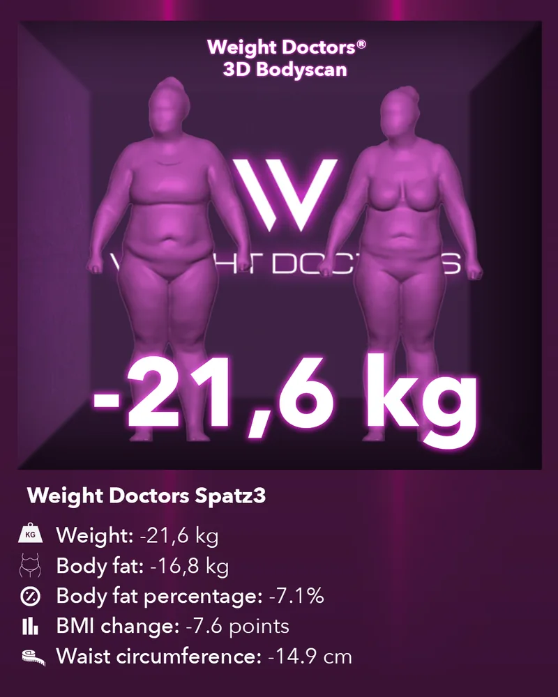Weight Doctors® 3D Bodyscan before and after: minus 21.6 kg with the Spatz3 gastric balloon, body fat minus 16.8 kg