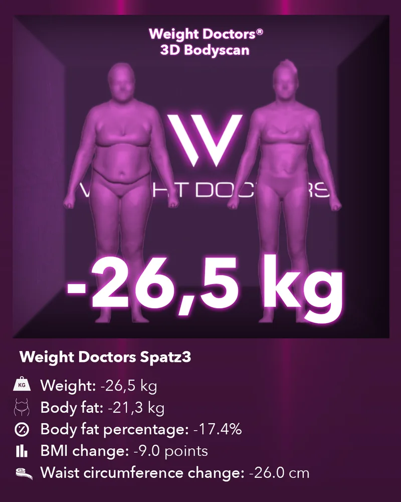 Weight Doctors® 3D Bodyscan before and after: minus 26.5 kg with the Spatz3 gastric balloon, body fat minus 21.3 kg