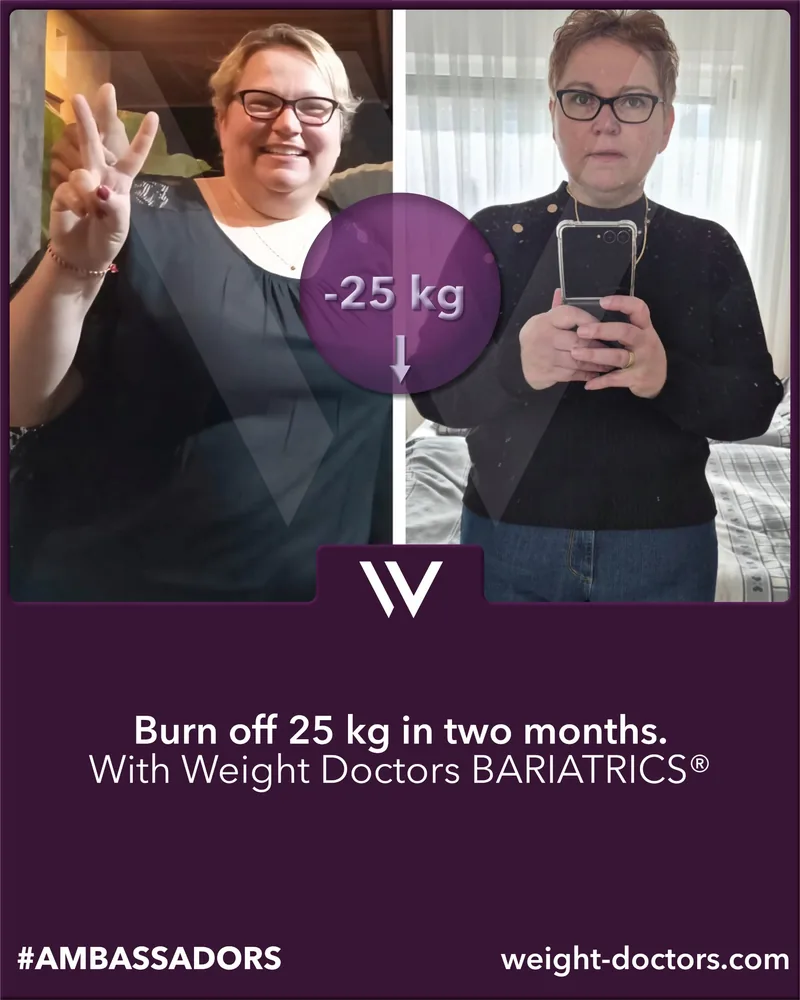 Weight Doctors® before and after: female patient 25 kg lighter in two months, with Weight Doctors BARIATRICS®