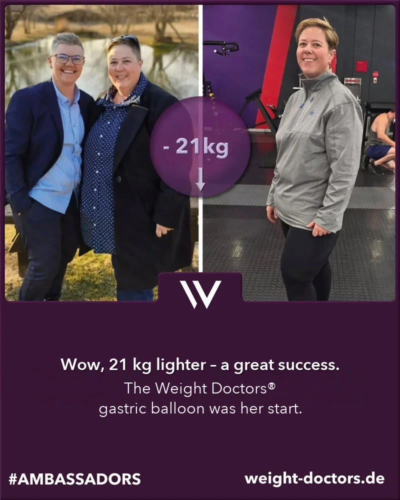 Weight Doctors® before and after: Elli 21 kg lighter, with the Weight Doctors® GASTRIC BALLOON