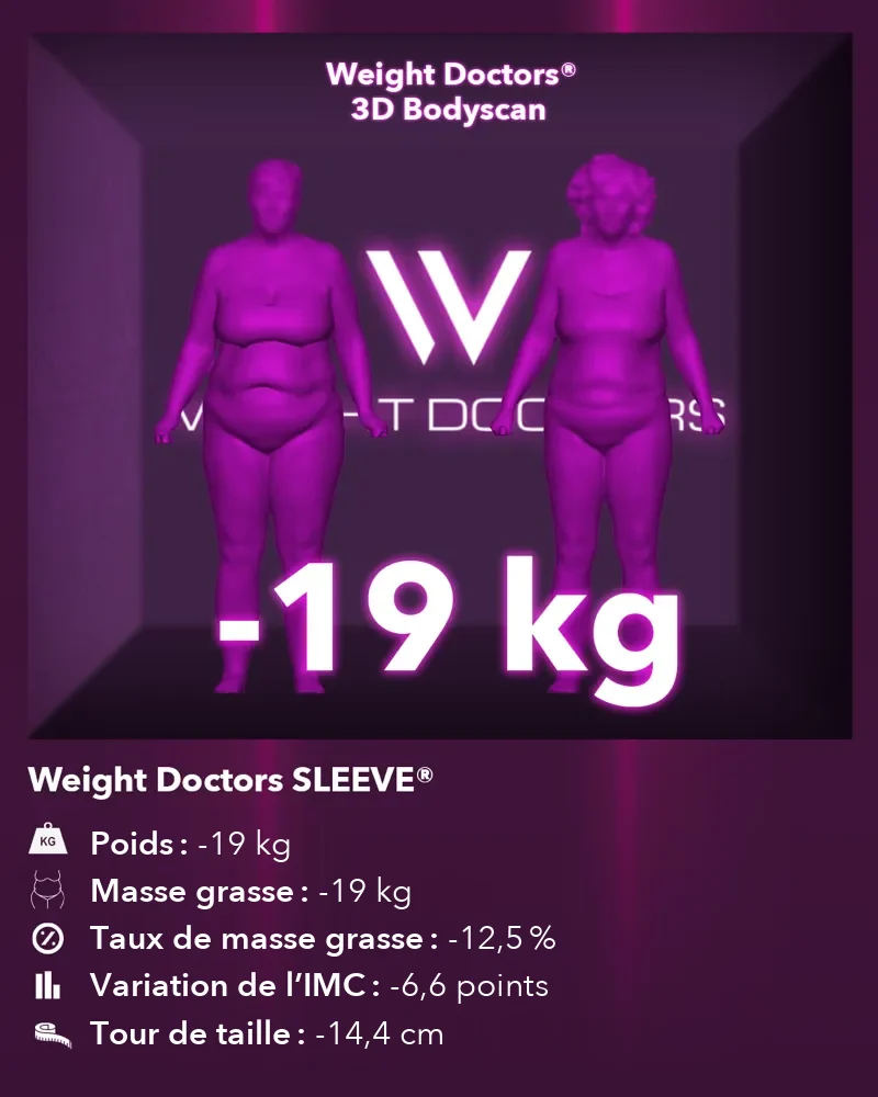 3D Bodyscan Weight Doctors® avant et après&nbsp;: moins 19 kg avec le Weight Doctors SLEEVE®, graisse corporelle moins 19 kg