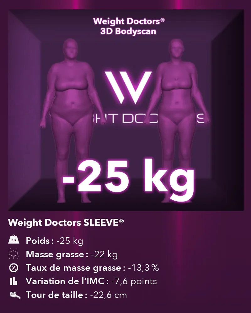 Weight Doctors® 3D Bodyscan avant et après&nbsp;: moins 25 kg avec Weight Doctors SLEEVE®, masse grasse moins 22 kg