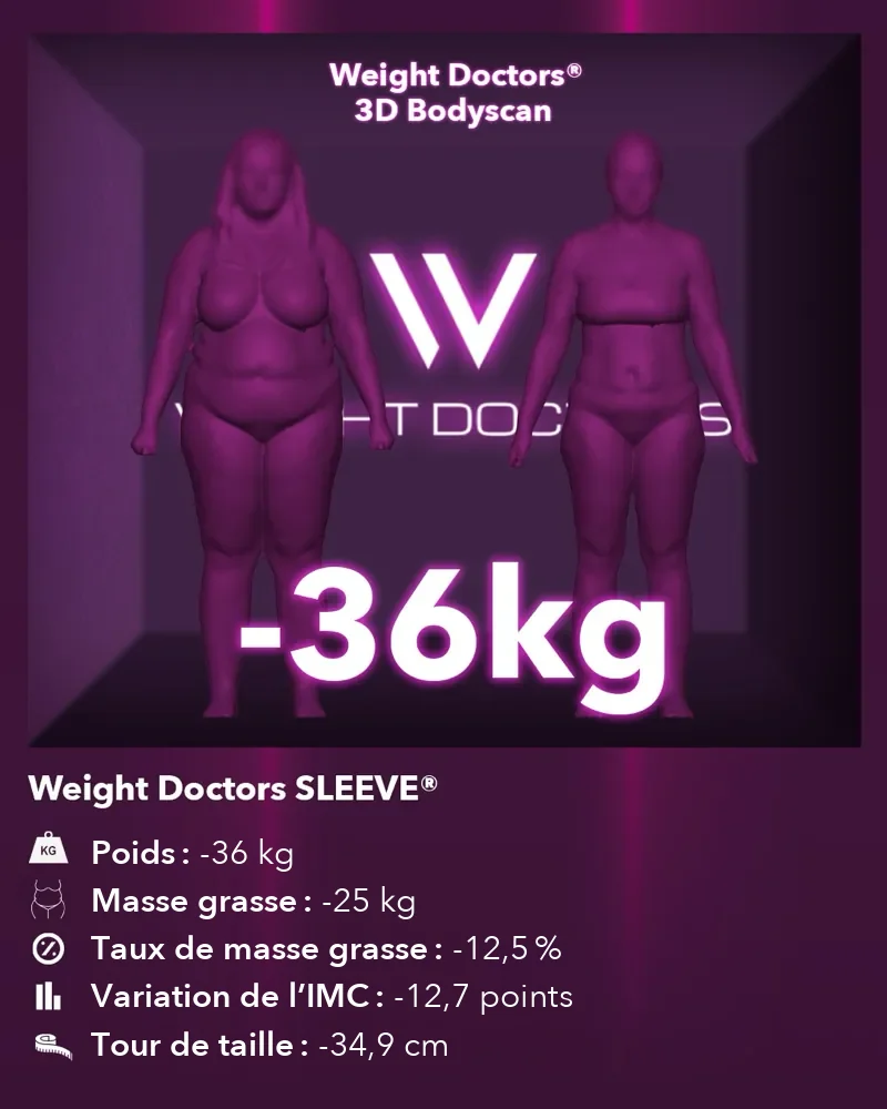 Weight Doctors® 3D Bodyscan avant et après&nbsp;: moins 36 kg avec Weight Doctors SLEEVE®, masse grasse moins 25 kg