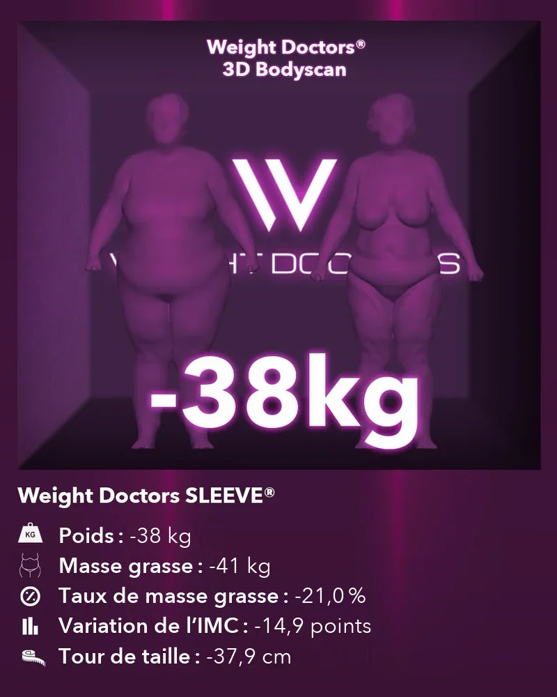 Weight Doctors® 3D Bodyscan avant et après&nbsp;: moins 38 kg avec Weight Doctors SLEEVE®, masse grasse moins 41 kg