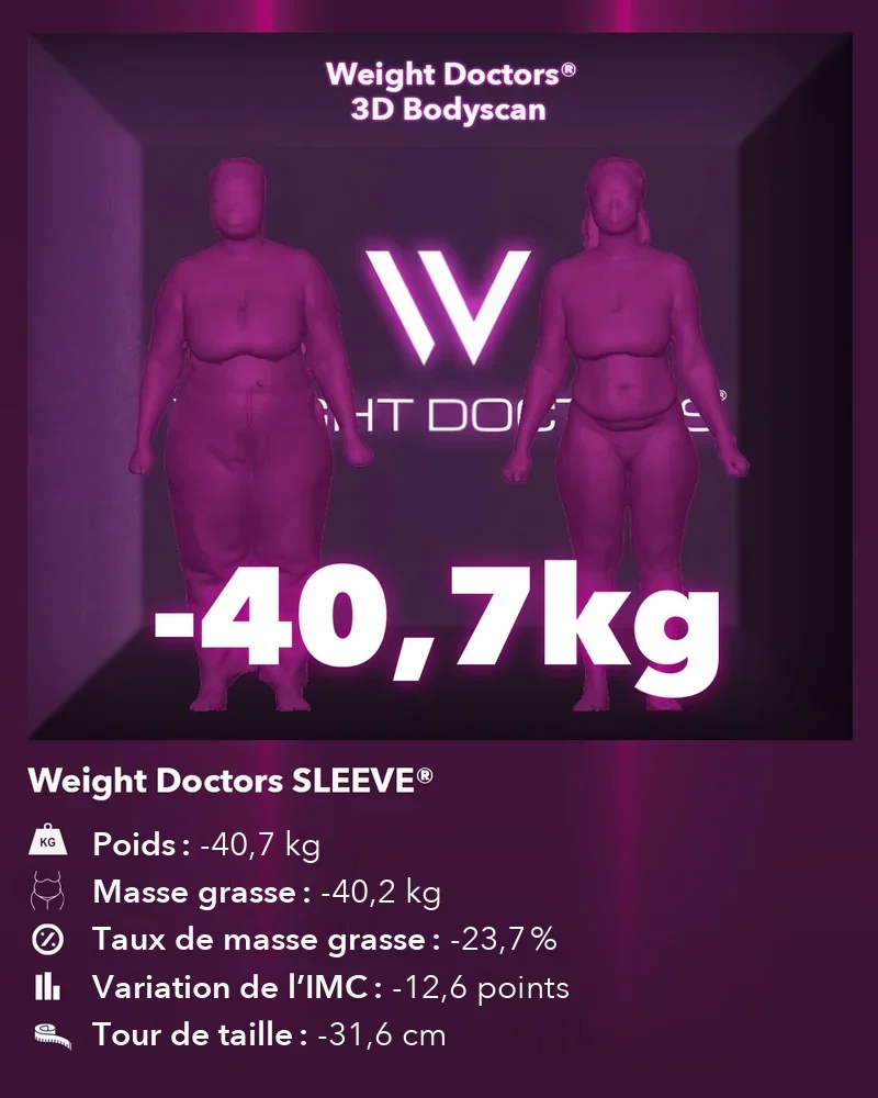 Weight Doctors® 3D Bodyscan avant et après&nbsp;: moins 40,7 kg avec Weight Doctors SLEEVE®, masse grasse moins 40,2 kg