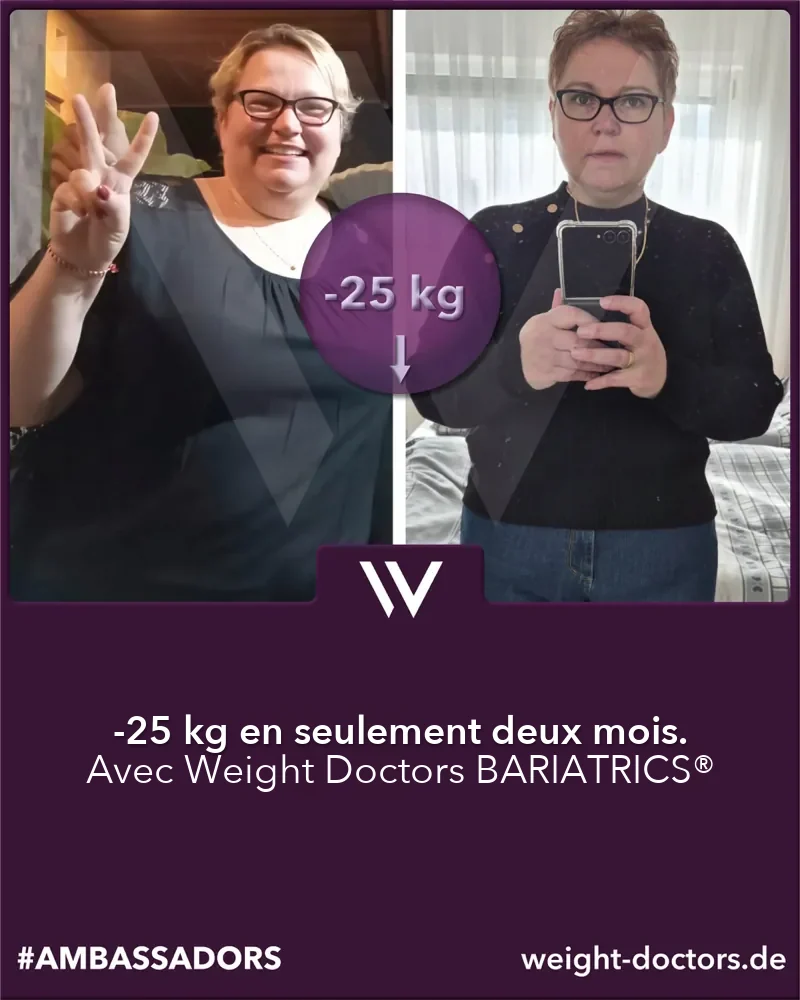 Weight Doctors® avant et après&nbsp;: patiente avec 25 kg de moins en deux mois, avec Weight Doctors BARIATRICS®
