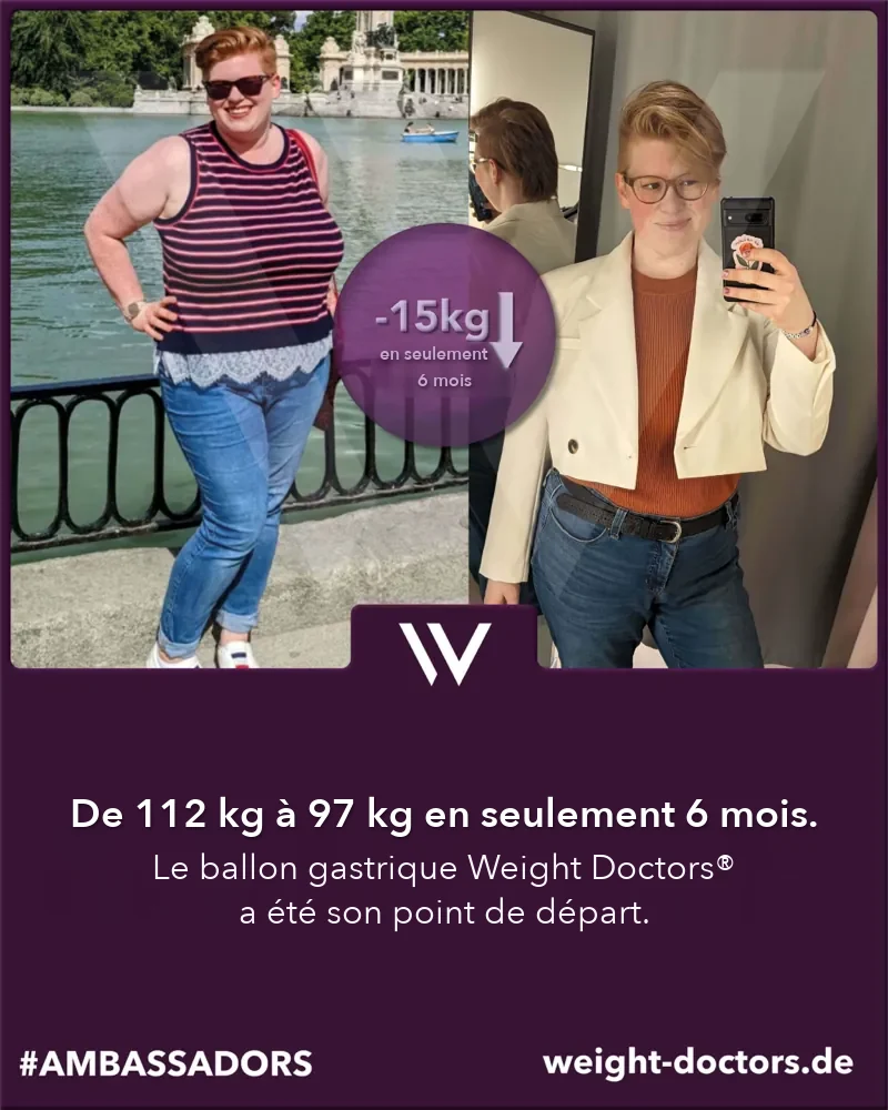 Weight Doctors® avant et après&nbsp;: patiente passée de 112 kg à 97 kg en six mois, avec le Weight Doctors® BALLON GASTRIQUE