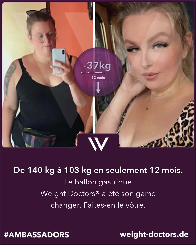 Avant-après Weight Doctors®&nbsp;: une patiente passe de 140 kg à 103 kg en douze mois, avec le Weight Doctors® BALLON GASTRIQUE