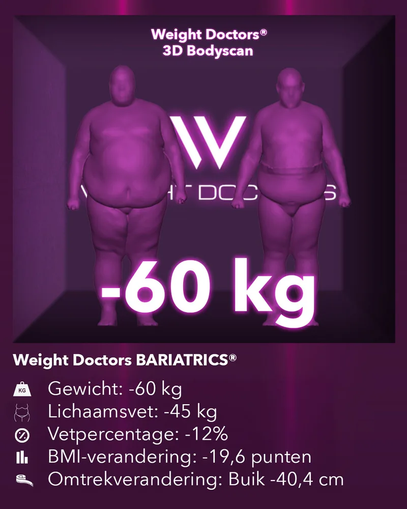 Weight Doctors® 3D Bodyscan voor en na: min 60 kg met Weight Doctors BARIATRICS®, lichaamsvet min 45 kg