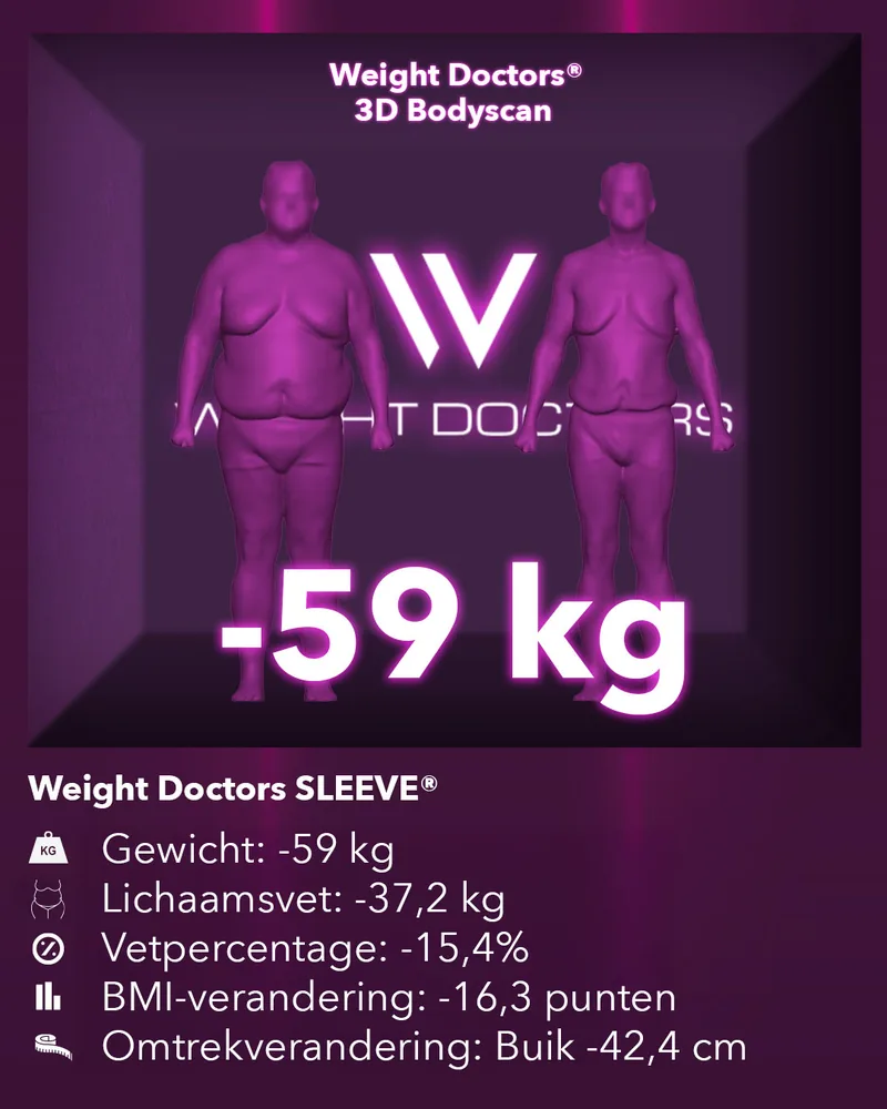 Weight Doctors® 3D Bodyscan voor en na: min 59 kg met Weight Doctors SLEEVE®, lichaamsvet min 37,2 kg