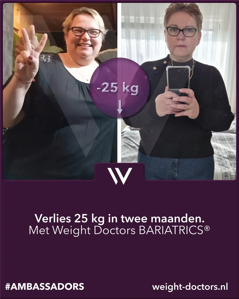 Weight Doctors® voor en na: patiënte met 25 kg minder in twee maanden, met Weight Doctors BARIATRICS®