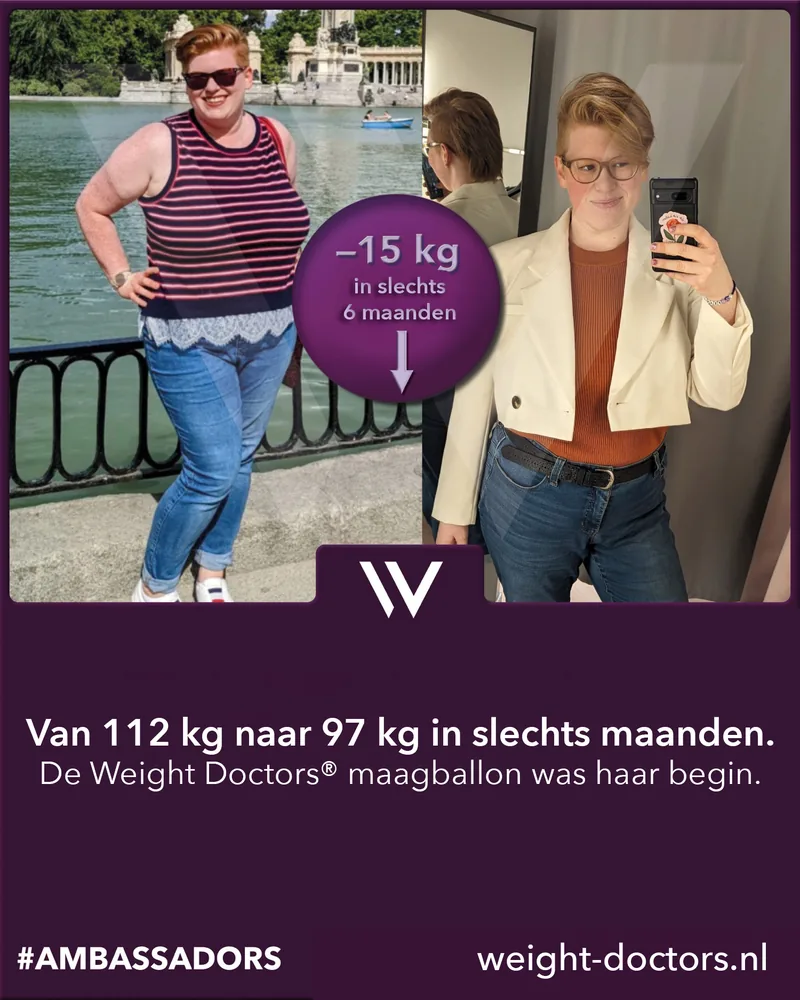 Weight Doctors® voor en na: patiënte van 112 kg naar 97 kg in zes maanden, met de Weight Doctors® MAAGBALLON
