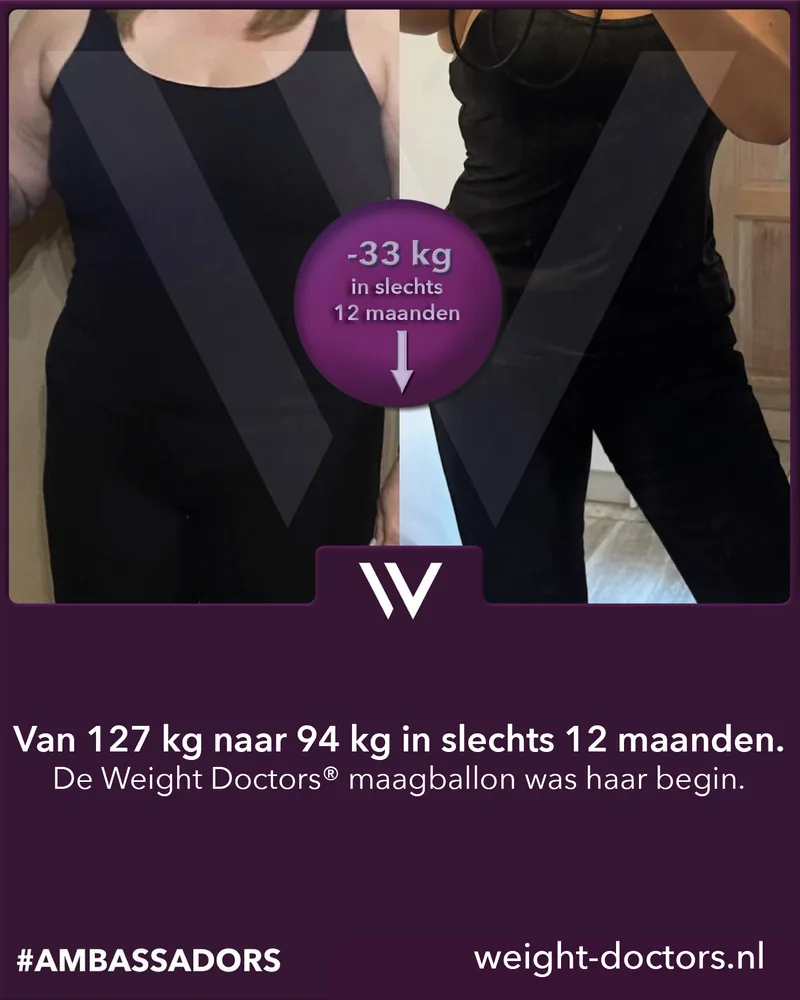 Weight Doctors® voor en na: patiënte van 127 kg naar 94 kg in twaalf maanden, met de Weight Doctors® MAAGBALLON