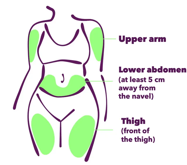 The possible injection sites: upper arm, lower abdomen (at least 5 cm from the navel) and the front of the thighs