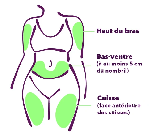 Les sites d’injection possibles : le haut du bras, le bas-ventre (à au moins 5 cm du nombril) et la face antérieure des cuisses