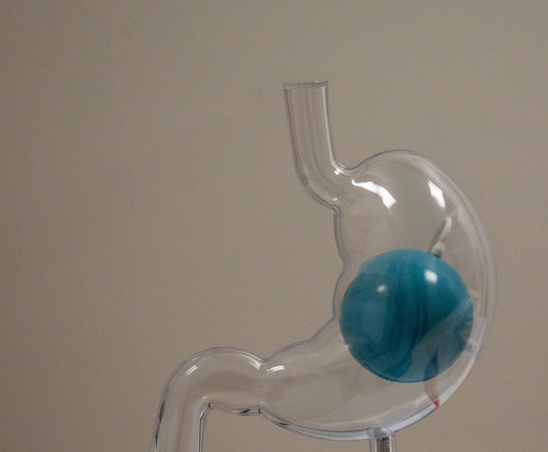 Doorzichtig maagmodel met een maagballon